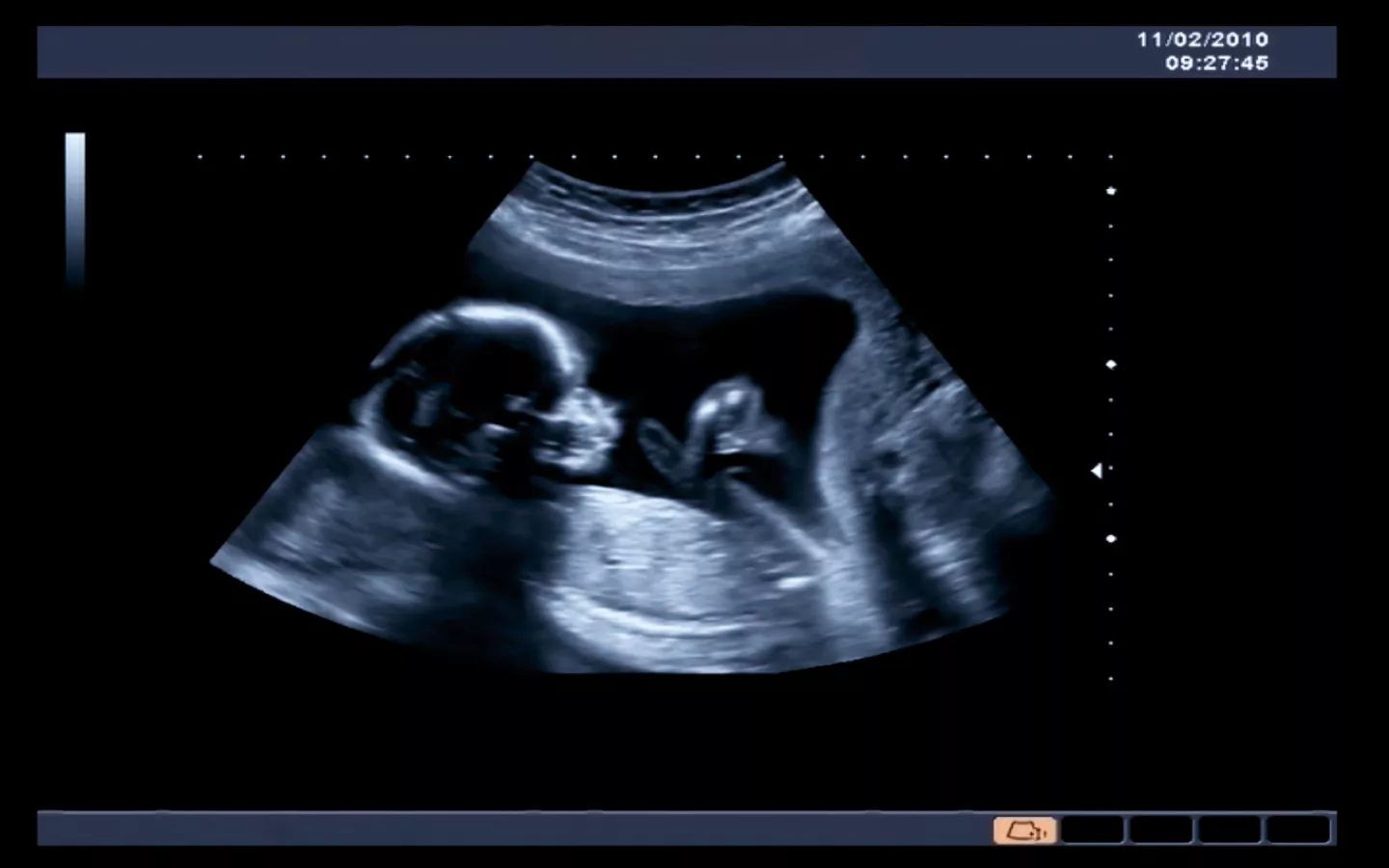 Echographie et grossesse